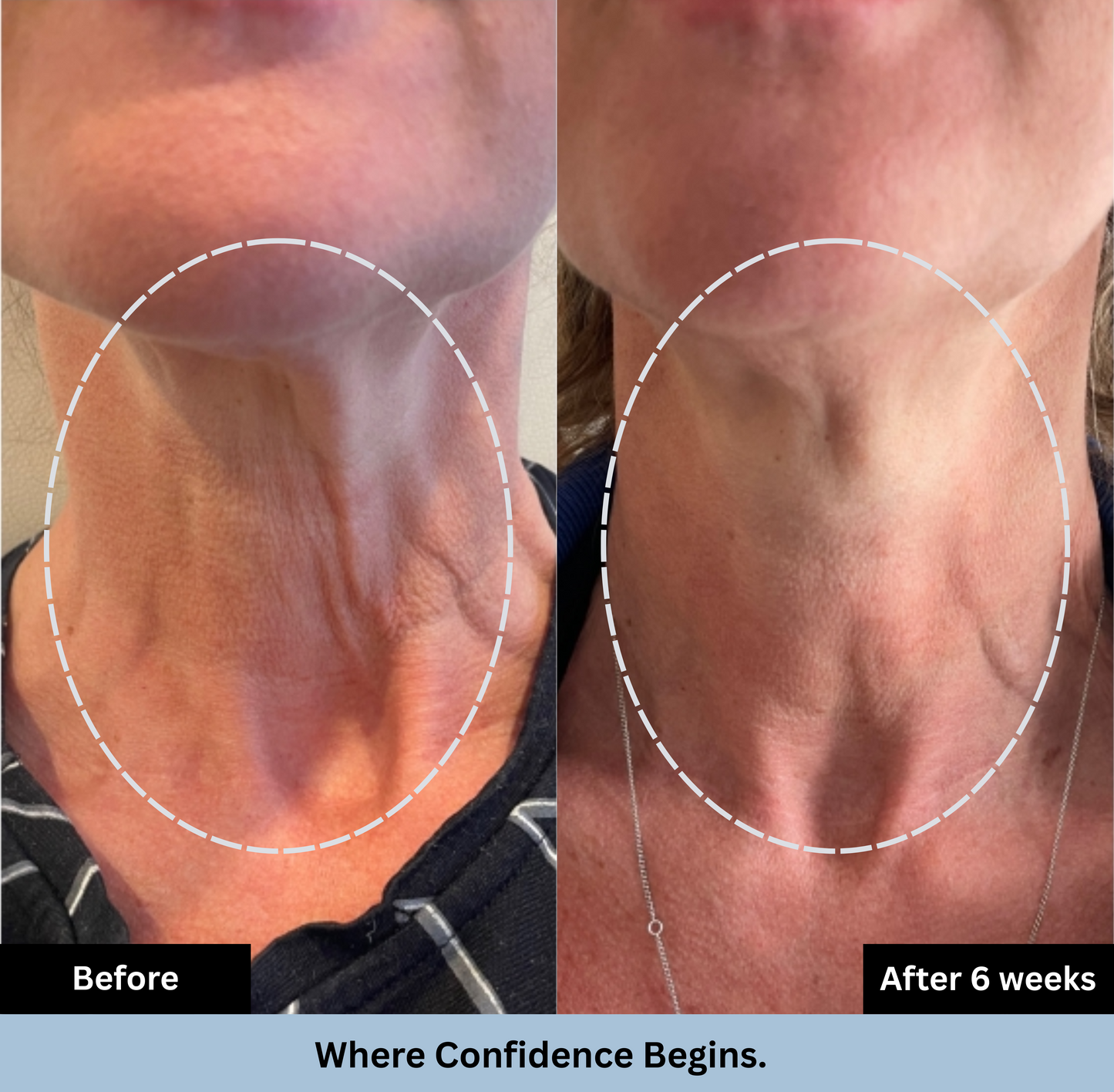 GlowWave™ Tighten & Lift Neck Cream