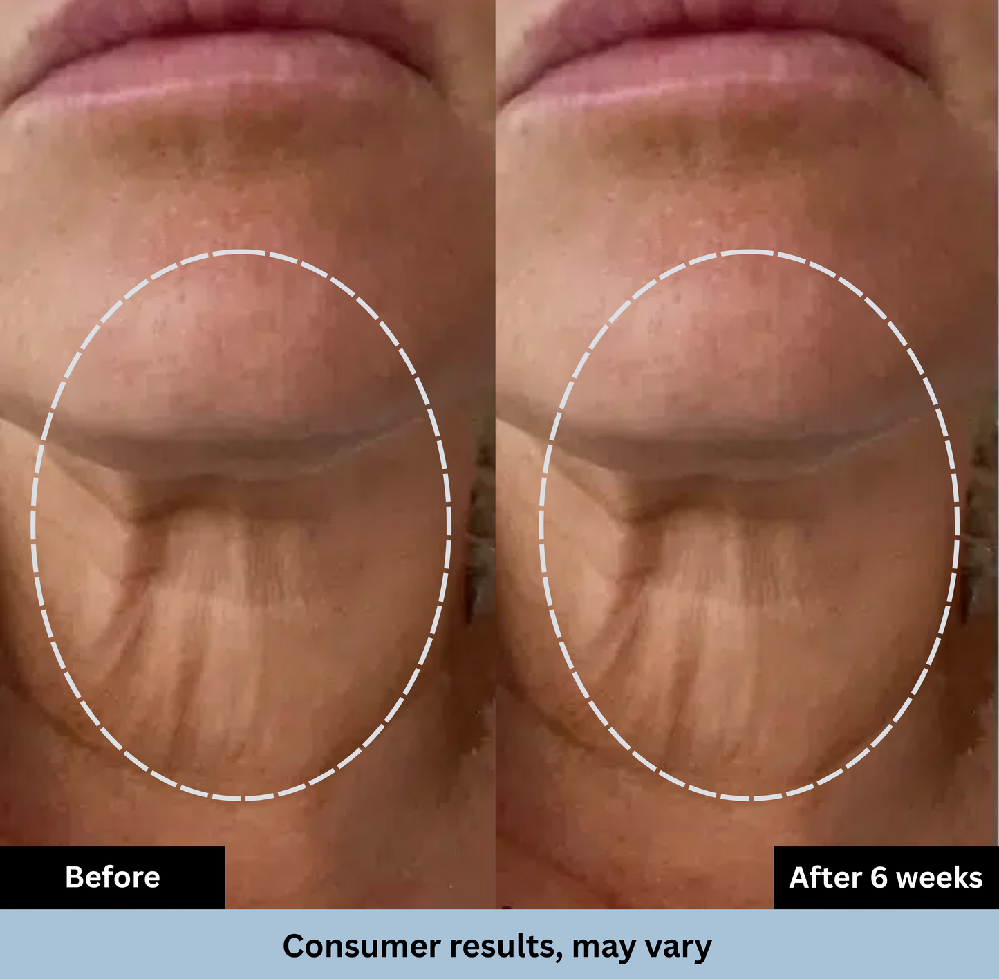 GlowWave™ Tighten & Lift Neck Cream
