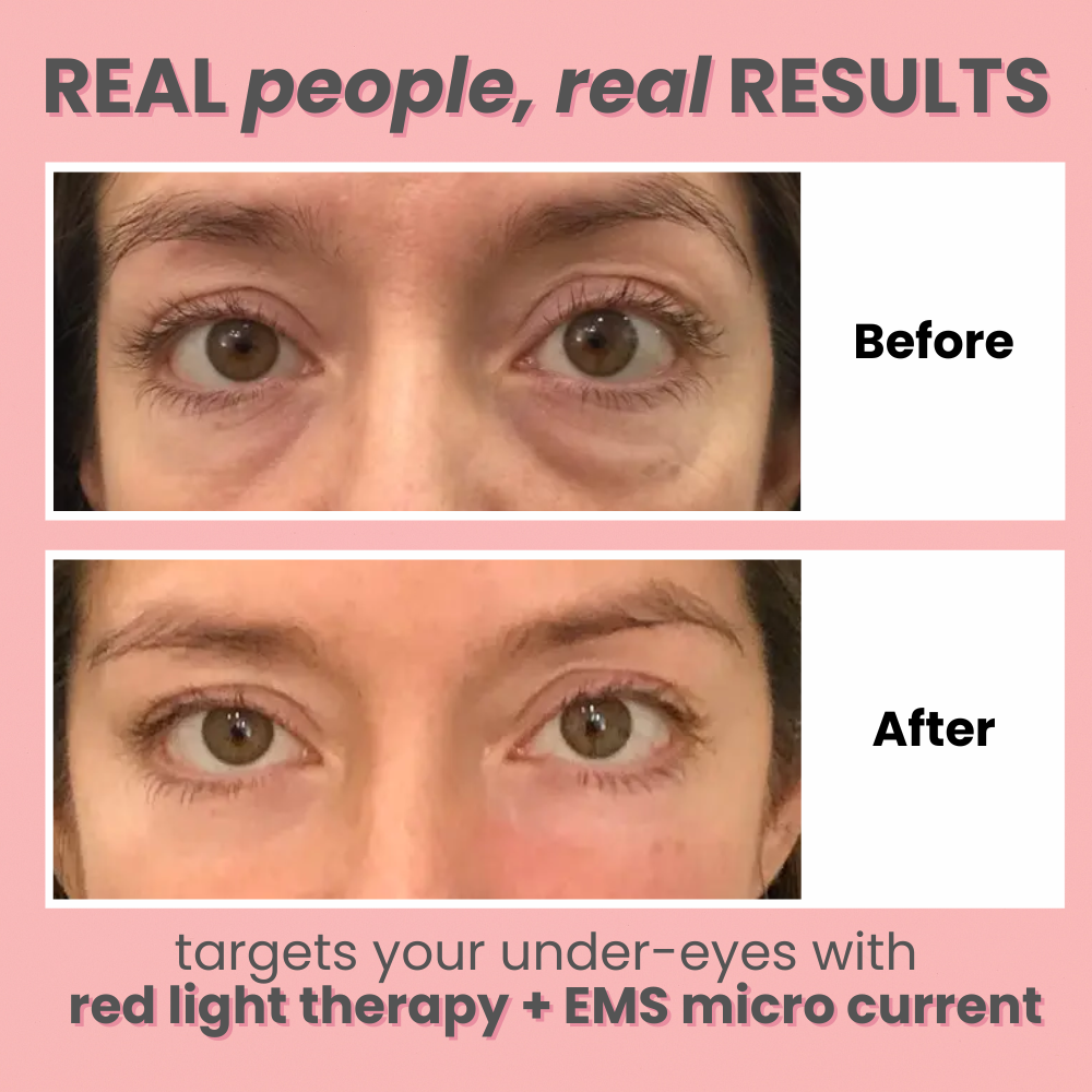 GlowWave™ Under-Eye Therapy