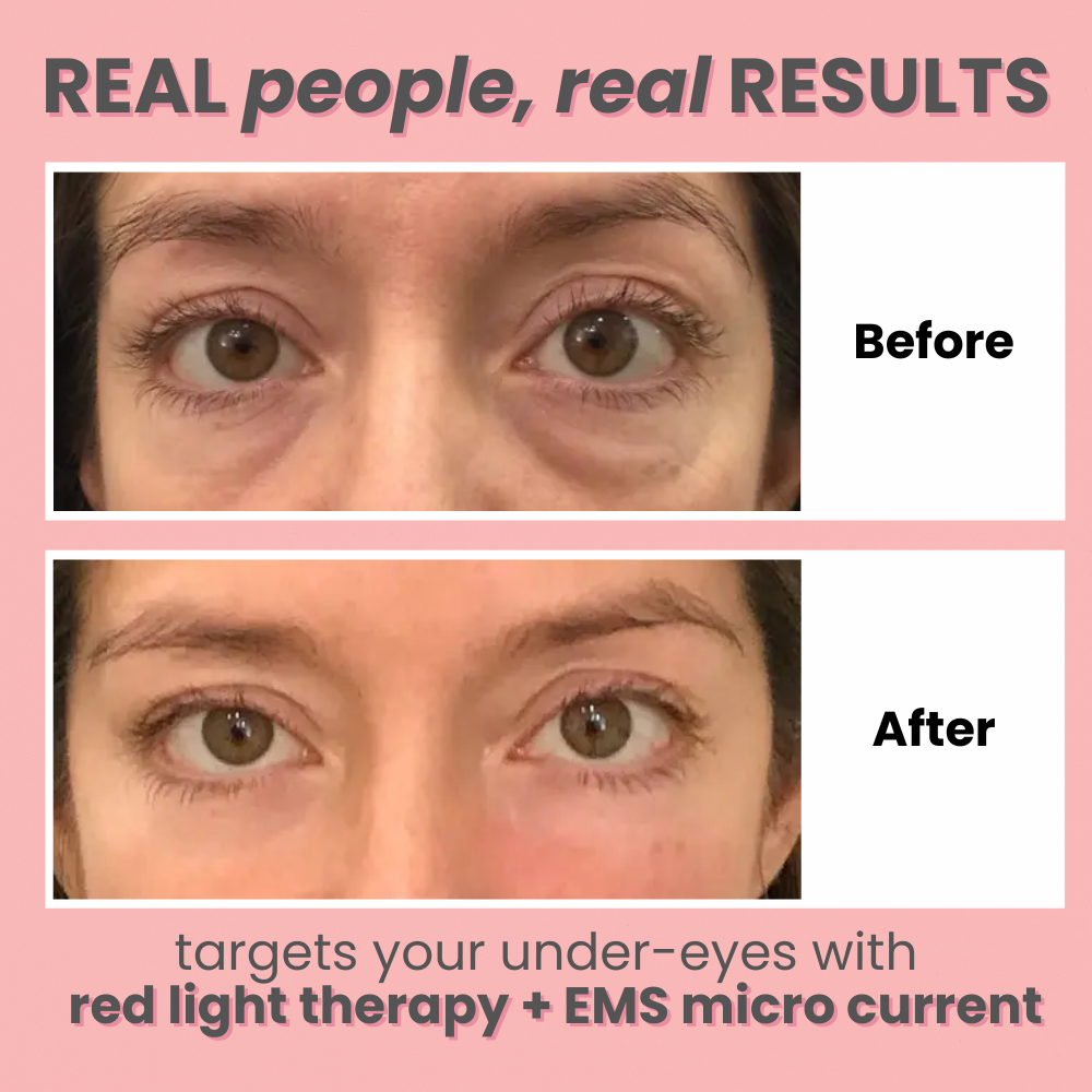 GlowWave™ Under-Eye Red Light Therapy